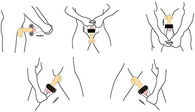 Jelching是一种用于阴茎自我增大的按摩技术。